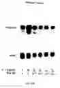 Fig. 22 - SOFT TISSUE IMPLANTS AND ANTI-SCARRING AGENTS