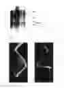 Fig. 09 - Bone morphogenetic protein 4 and osteogenic devices and pharmaceutical products containing thereof