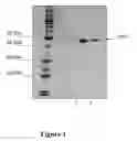 Fig. 02 - Surface-layer protein coated microspheres and uses thereof