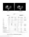 Fig. 02 - COMPOSITIONS FOR PROTECTION AGAINST ELECTROMAGNETIC RADIATION EXPOSURE