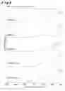 Fig. 08 - Thermodynamically stable form of a tosylate salt