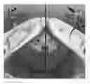 Fig. 01 - Urinary incontinence sling apparatus and method