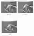 Fig. 03 - Urinary incontinence sling apparatus and method