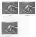 Fig. 04 - Urinary incontinence sling apparatus and method