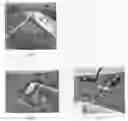 Fig. 05 - Urinary incontinence sling apparatus and method