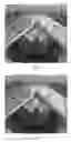 Fig. 07 - Devices and Methods for Placing Slings and Other Materials