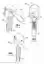 Fig. 03 - Vaginal speculum