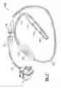 Fig. 13 - Vaginal speculum