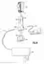 Fig. 23 - Vaginal speculum