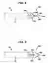 Fig. 08 - Needle tip for biopsy device