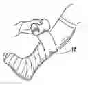 Fig. 01 - Nonwoven splinting and casting product