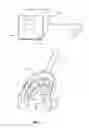 Fig. 02 - Method And Apparatus For Preventing Localized Stasis Of Cerebrospinal Fluid