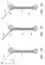 Fig. 40 - MODULAR SEGMENTED INTRAMEDULLARY SYSTEM, APPARATUS AND METHODS
