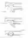 Fig. 07 - Methods and apparatus for treating ventral wall hernia