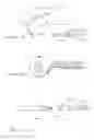 Fig. 08 - Methods and apparatus for treating ventral wall hernia