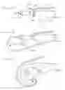 Fig. 09 - Methods and apparatus for treating ventral wall hernia