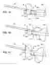 Fig. 02 - Gastric retaining devices and methods