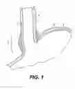 Fig. 02 - Tissue fasteners and related deployment systems and methods