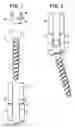 Fig. 02 - Methods for correction of spinal deformities