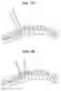 Fig. 07 - Methods for correction of spinal deformities