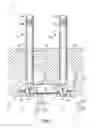 Fig. 02 - Installation systems for spinal stabilization system and related methods