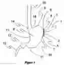Fig. 02 - Methods and apparatus for neuromodulation and physiologic modulation for the treatment of obesity and metabolic and neuropsychiatric disease
