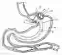 Fig. 01 - GASTRIC BYPASS PROSTHESIS FIXATION SYSTEM AND METHOD FOR TREATMENT OF OBESITY