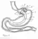 Fig. 02 - GASTRIC BYPASS PROSTHESIS FIXATION SYSTEM AND METHOD FOR TREATMENT OF OBESITY