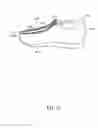Fig. 07 - Front-opening footwear systems