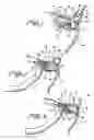 Fig. 02 - Bicycle transmission shift control apparatus
