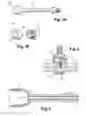 Fig. 02 - DEVICE FOR SUPPLYING PASTY MATERIAL