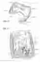 Fig. 08 - Methods of using a particle impact drilling system for removing near-borehole damage, milling objects in a wellbore, under reaming, coring, perforating, assisting annular flow, and associated methods