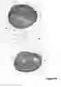 Fig. 06 - Packing for Injection Device