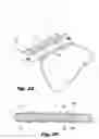 Fig. 09 - Structure for attachment of buttress material to anvils and cartridges of surgical staplers