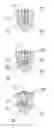 Fig. 02 - HARD ELEMENTS FOR THE AUTOGENOUS WEAR PROTECTION OF ROLLER SURFACES