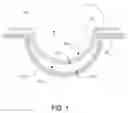 Fig. 02 - METHODS AND SYSTEMS FOR PROCESSING SILICONE HYDROGEL OPHTHALMIC LENSES FOR IMPROVED LENS TRANSFER