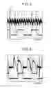 Fig. 05 - Apparatus and method for detecting an abnormality of a generator for vehicles