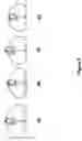Fig. 11 - Sensor protection systems and methods