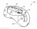 Fig. 01 - Hearing aid noise reduction method, system, and apparatus