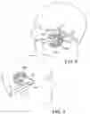 Fig. 06 - Behind-the-head mounted personal audio set with adjustable earphone position
