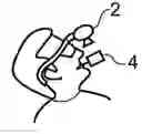Fig. 01 - TRACKING SYSTEM FOR ORTHOGNATHIC SURGERY