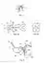 Fig. 02 - TRACKING SYSTEM FOR ORTHOGNATHIC SURGERY
