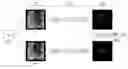 Fig. 01 - METHOD FOR PROCESSING IMAGES OF INTERVENTIONAL RADIOLOGY