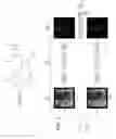 Fig. 02 - METHOD FOR PROCESSING IMAGES OF INTERVENTIONAL RADIOLOGY