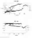 Fig. 04 - METHOD FOR PROCESSING IMAGES OF INTERVENTIONAL RADIOLOGY