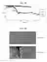 Fig. 05 - METHOD FOR PROCESSING IMAGES OF INTERVENTIONAL RADIOLOGY