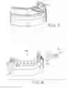 Fig. 04 - Method of merging anatomical data and surface data of a patient's dentition