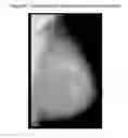 Fig. 07 - Fast preprocessing algorithms for digital mammography CAD and workstation