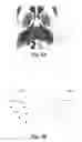 Fig. 11 - Method and apparatus for registration of an atlas to an image