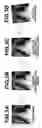 Fig. 03 - Chest image rotation apparatus, method and recording-medium stored therein program